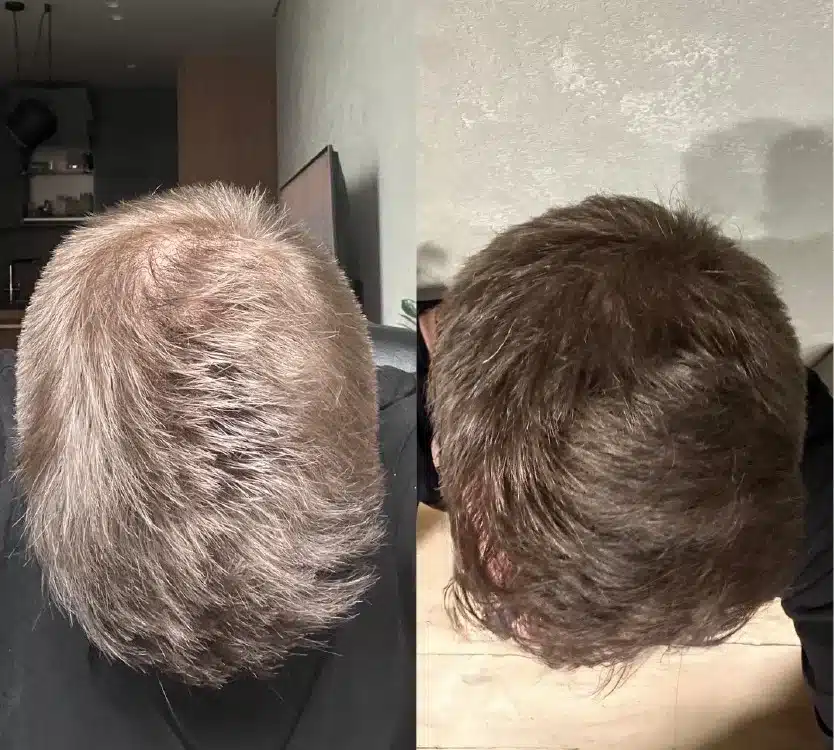 Hair care set