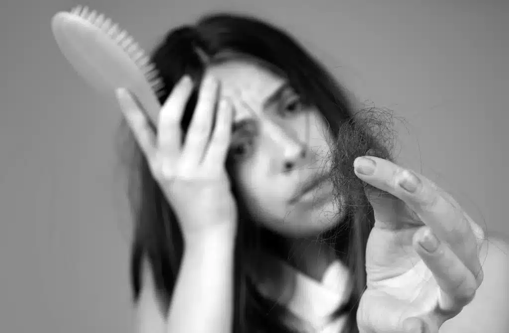 woman hair loss